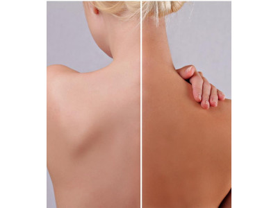 Як правильно підібрати автозагар?