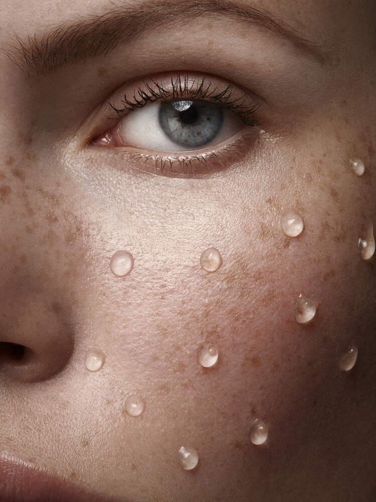 Який тип шкіри можемо віднести до проблемної